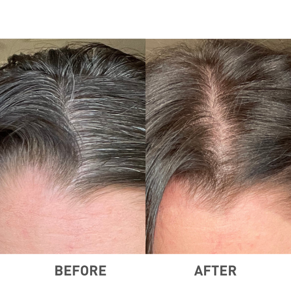 BEFORE AFTER (1)