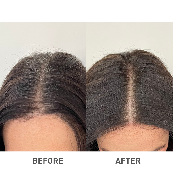 BEFORE AFTER (5)